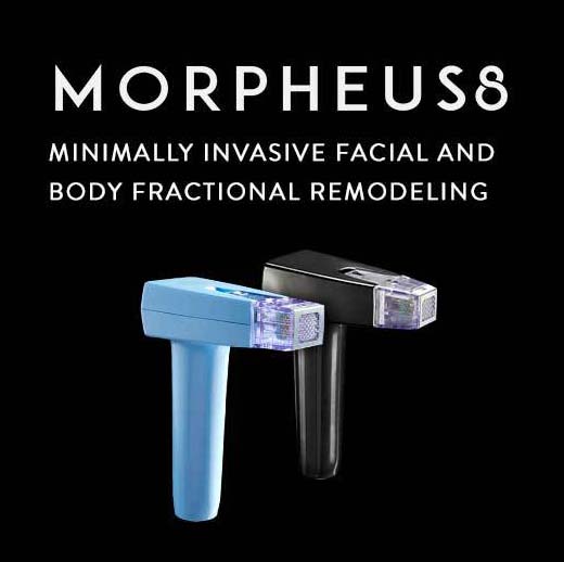 Morpheus8 - Hyperhydrosis (excessive sweat)